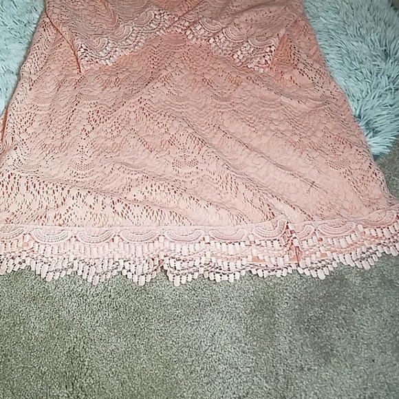 Lace H&M Dress - Picture 5 of 6